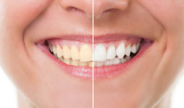 5 Dental Products you Need for a Great Smile